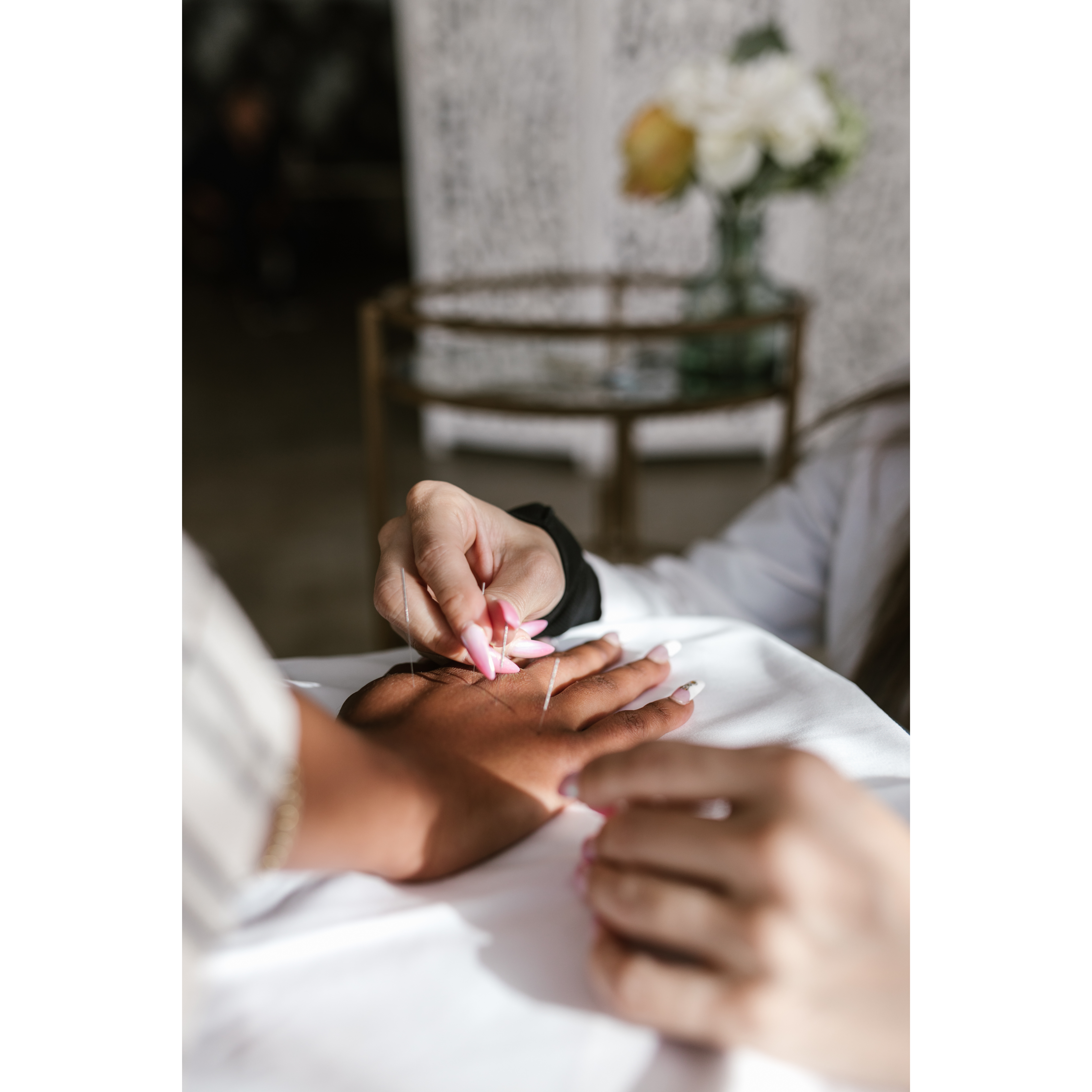 Acupuncturehands A person's right hand on the table, receiving acupuncture treatment